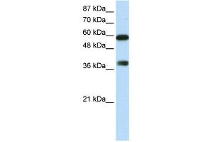 WB Suggested Anti-ARID3B  Antibody Titration: 0. (ARID3B Antikörper  (C-Term))