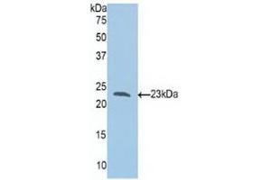Detection of Recombinant Slit1, Human using Polyclonal Antibody to Slit Homolog 1 (Slit1) (SLIT1 Antikörper  (AA 647-835))