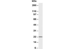 Western blot testing of PMVK antibody and rat heart tissue lysate (PMVK Antikörper  (Middle Region))