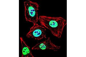 Fluorescent confocal image of Hela cell stained with HDAC2 Antibody (Center) (ABIN653718 and ABIN2843029). (HDAC2 Antikörper  (AA 410-439))