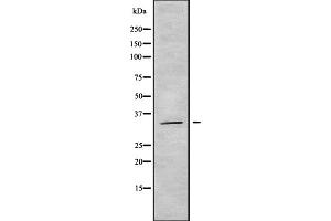 Western blot analysis OR5AT1 using COLO205 whole cell lysates (OR14A16 Antikörper  (Internal Region))
