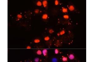 Immunofluorescence analysis of HeLa cells using HMGB2 Polyclonal Antibody at dilution of 1:100. (HMGB2 Antikörper)