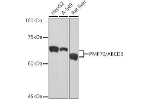 Western blot analysis of extracts of various cell lines, using PMP70/ Rabbit mAb (ABIN1683181, ABIN3018647, ABIN3018648 and ABIN7101638) at 1:1000 dilution. (CX3CL1 Antikörper)