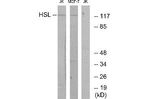 Immunohistochemistry analysis of paraffin-embedded human tonsil tissue using HSL (Ab-552) antibody. (LIPE Antikörper  (Ser552))