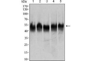 Western blot analysis using TUBB2A mouse mAb against HeLa (1), A549 (2), HEK293 (3), Jurkat (4) and PC-12 (5) cell lysate.