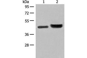 Western blot analysis of 231 cell and Human fetal liver tissue lysates using INPP1 Polyclonal Antibody at dilution of 1:500 (INPP1 Antikörper)