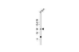 Anti-IGFBP-3 Antibody at 1:1000 dilution + human liver lysate Lysates/proteins at 20 μg per lane.