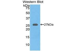 Western Blotting (WB) image for anti-Axin 1 (AXIN1) (AA 654-863) antibody (ABIN3205356) (Axin Antikörper  (AA 654-863))