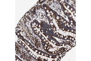 Immunohistochemical staining of human colon with COG5 polyclonal antibody  shows strong cytoplasmic positivity in granular pattern in glandular cells.