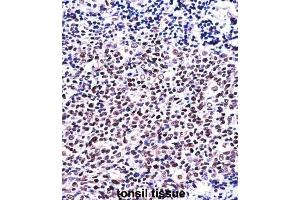 Immunohistochemistry (IHC) image for anti-Nuclear Factor of Activated T-Cells, Cytoplasmic, Calcineurin-Dependent 1 (NFATC1) antibody (ABIN2997610) (NFATC1 Antikörper)