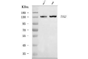 Western blot analysis of TYK2 using anti-TYK2 antibody (ABIN7602085).