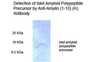 Rat pancreas tissue homogenate on 15 % Tricine_PAGE (reduce condition) Primary Antibody 1:500 (Amylin/DAP Antikörper  (AA 1-13))