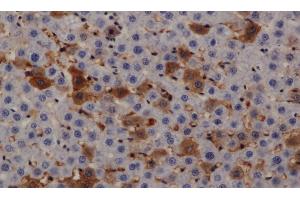 Immunohistochemistry of paraffin-embedded Rat liver using PRKD3 Polyclonal Antibody at dilution of 1:200 (PRKD3 Antikörper)