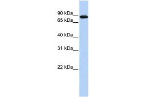 WB Suggested Anti-HTATSF1 Antibody Titration: 0.