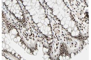 Immunohistochemistry (IHC) image for anti-TAF1 RNA Polymerase II, TATA Box Binding Protein (TBP)-Associated Factor, 250kDa (TAF1) (Internal Region) antibody (ABIN6265434)