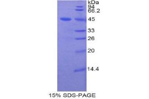 SDS-PAGE (SDS) image for Lipocalin 8 (LCN8) (AA 25-176) protein (His tag,GST tag) (ABIN1878494)