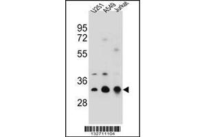Western blot analysis in U251,A549,Jurkat cell line lysates (35ug/lane). (Tropomyosin 4 Antikörper  (N-Term))