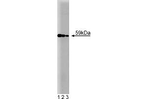 Western Blotting (WB) image for anti-V-Akt Murine Thymoma Viral Oncogene Homolog 1 (AKT1) antibody (ABIN968218) (AKT1 Antikörper)