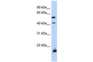 Image no. 1 for anti-Developing Brain Homeobox 1 (DBX1) (AA 248-297) antibody (ABIN6741082) (DBX1 Antikörper  (AA 248-297))