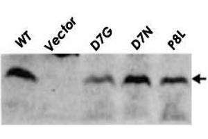 Detection of RuvC (19kD) proteins in the cell extracts of E. (RuvC Antikörper)