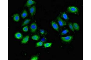 Immunofluorescent analysis of A549 cells using ABIN7163717 at dilution of 1:100 and Alexa Fluor 488-congugated AffiniPure Goat Anti-Rabbit IgG(H+L) (PLXND1 Antikörper  (AA 1-222))