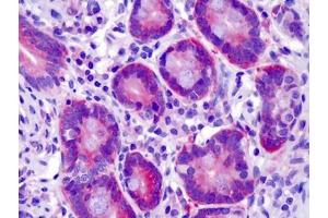 Immunohistochemistry (Paraffin-embedded Sections) (IHC (p)) image for anti-Suppression of Tumorigenicity 14 (ST14) (N-Term) antibody (ABIN615862)