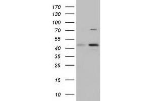 HEK293T cells were transfected with the pCMV6-ENTRY control (Left lane) or pCMV6-ENTRY CBWD1 (Right lane) cDNA for 48 hrs and lysed. (CBWD1 Antikörper)