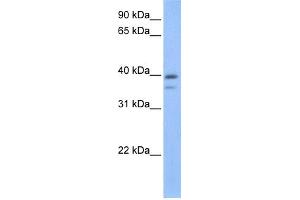 WB Suggested Anti-VPS26B Antibody Titration: 0. (VPS26B Antikörper  (C-Term))
