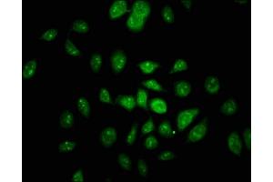 Neurofibromin 1 Antikörper  (AA 655-892)