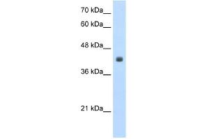 WB Suggested Anti-RP11-82K18. (CCBL2 Antikörper  (N-Term))