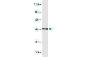 Western Blot detection against Immunogen (48. (RAB7L1 Antikörper  (AA 1-203))
