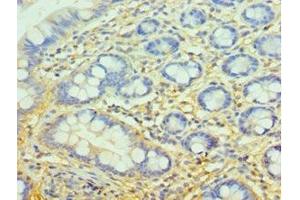 Immunohistochemistry of paraffin-embedded human small intestine tissue using ABIN7148385 at dilution of 1:100
