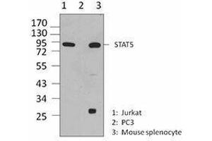 Western Blotting (WB) image for anti-Signal Transducer and Activator of Transcription 5A (STAT5A) antibody (ABIN2666295) (STAT5A Antikörper)