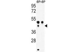 Western blot analysis of ATF4 antibody pre-incubated without (Lane 1) and with (2) blocking peptide in WiDr lysate
