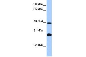 WB Suggested Anti-UBE2F Antibody Titration: 0. (UBE2F Antikörper  (N-Term))