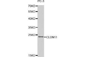 Western blot analysis of extracts of PC-3 cell line, using CLDN11 antibody. (Claudin 11 Antikörper  (AA 26-207))
