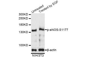 Western blot analysis of extracts of NIH/3T3 cells,using Phospho-eNOS-S1177 antibody (ABIN5995597) at 1/1000 dilution. (ENOS Antikörper  (pSer1177))