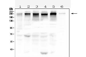 Western blot analysis of TJP1 using anti- TJP1 antibody . (TJP1 Antikörper  (AA 1178-1527))