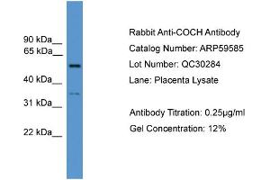 WB Suggested Anti-COCH  Antibody Titration: 0. (COCH Antikörper  (N-Term))