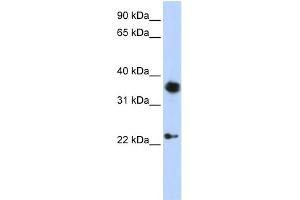 WB Suggested Anti-EN1 Antibody Titration:  0. (EN1 Antikörper  (C-Term))