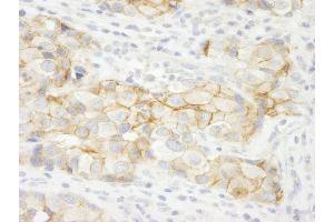 anti-C2 Calcium Dependent Domain Containing 5 (C2CD5) (AA 375-425) antibody
