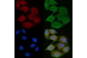 ABIN6258516 and ABIN6274735 staining Hela cells(45 min of heat-shock) by IF/ICC. (MRPL21 Antikörper  (Internal Region))