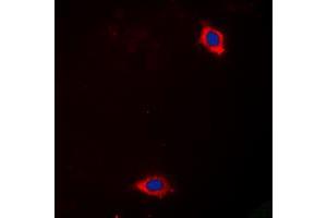 Immunofluorescent analysis of Laminin alpha 4 staining in Hela cells. (LAMa4 Antikörper  (Center))