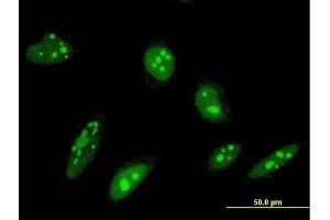Immunofluorescence of monoclonal antibody to ORC4L on HeLa cell. (ORC4 Antikörper  (AA 1-248))