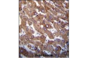 Hrk BH3 Domain Antibody (ABIN388104 and ABIN2846212) immunohistochemistry analysis in formalin fixed and paraffin embedded human liver tissue followed by peroxidase conjugation of the secondary antibody and DAB staining. (HRK Antikörper  (AA 15-50))