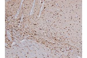 ABIN6267327 at 1/200 staining Rat brain tissue sections by IHC-P. (Tyrosine Hydroxylase Antikörper  (pSer19))