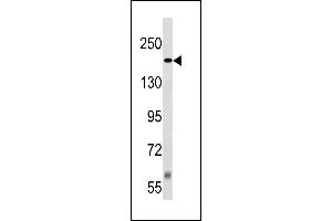 TSC2 Antibody (Center /) (ABIN1881944 and ABIN2843242) western blot analysis in Jurkat cell line lysates (35 μg/lane). (Tuberin Antikörper  (AA 1364-1393))