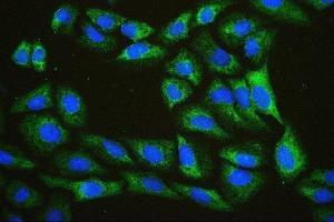 IF analysis of EIF4A using anti-EIF4A antibody (ABIN7601309). (EIF4A1 Antikörper  (AA 32-406))
