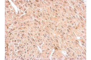 IHC-P Image CNP antibody detects CNP protein at cytosol on U87 xenograft by immunohistochemical analysis. (Cnpase Antikörper)