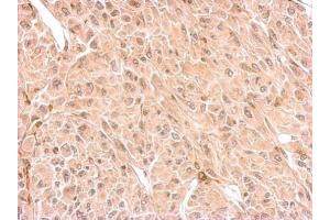IHC-P Image CNP antibody detects CNP protein at cytosol on U87 xenograft by immunohistochemical analysis.